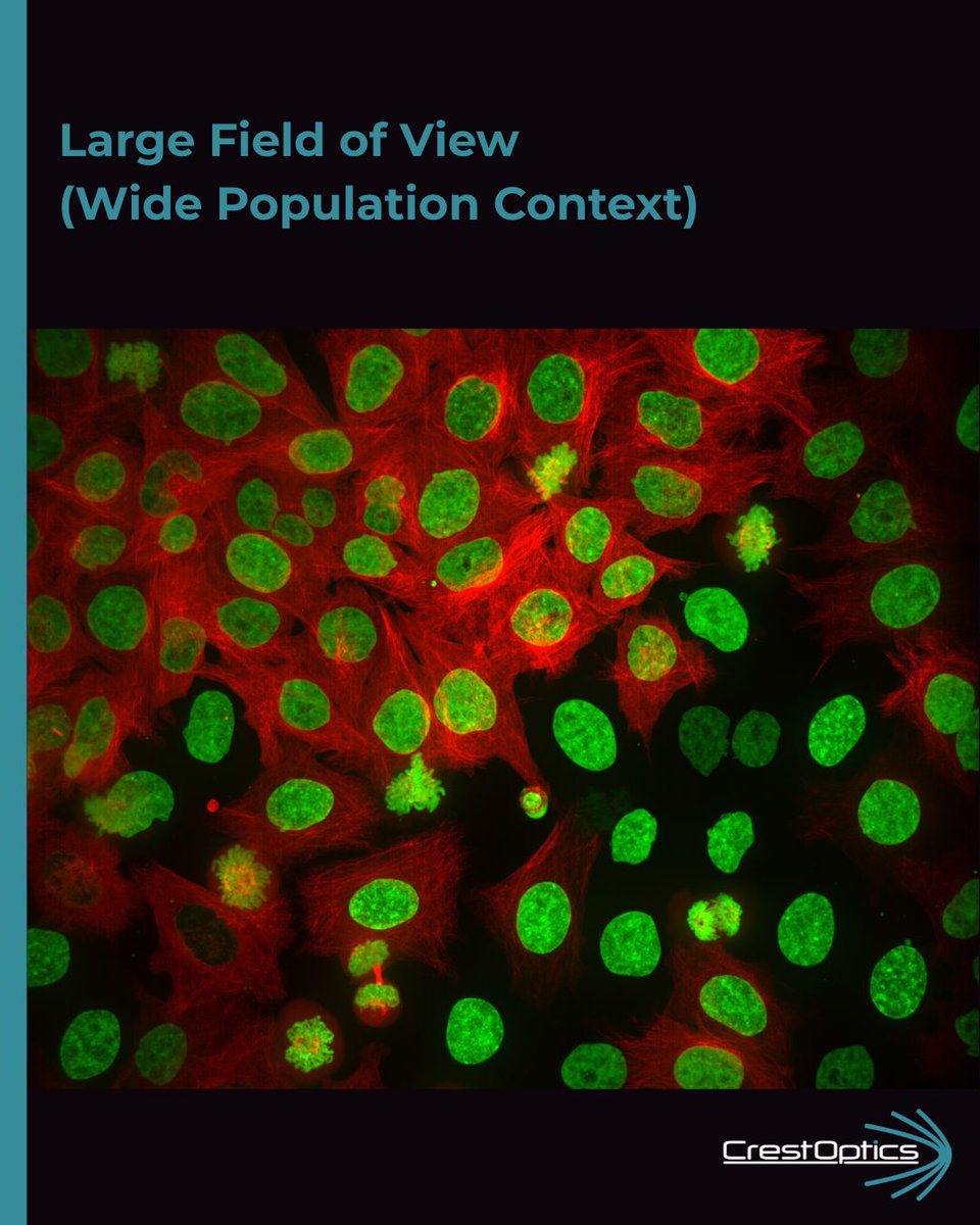 CrestOptics's tweet photo. 🔬 #ImageOfTheWeek | Powered by the #Multimodalmaging
Your samples hold complex stories, and limiting your view means missing half the picture.
📸 The images show what this looks like on HeLa cells: More here: https://t.co/q8cYALjpqx
#FluorescenceFriday #CrestOpticsCorrelative https://t.co/ym7rBBzRXq