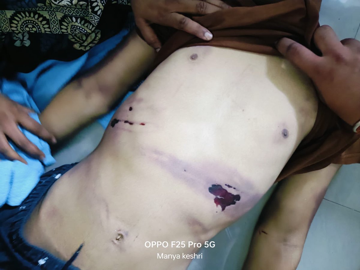 hastagvikas's tweet photo. CCTV footage from inside the rehabilitation centre is crucial evidence. Why has it not been
shown to the family or fully accounted for? @HemantSorenJMM @JMMKalpanaSoren
#JusticeForAkshat https://t.co/nK8MfM1tuw