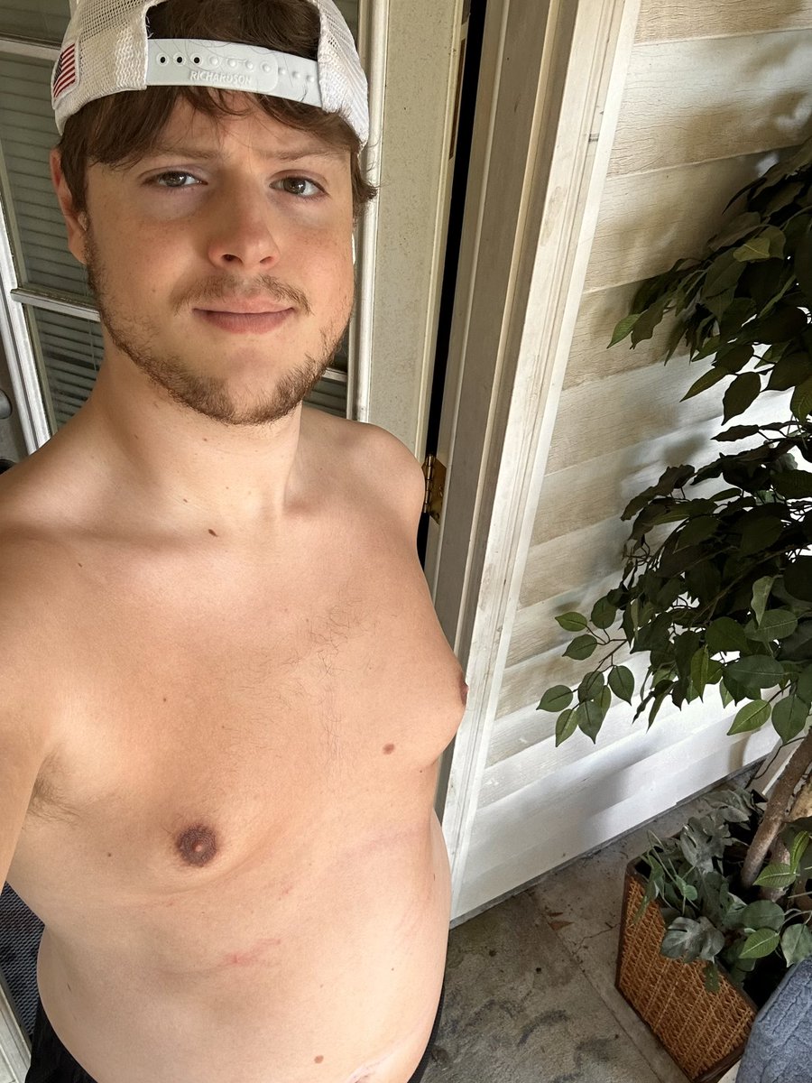 trashyprettyboy's tweet photo. got bit by a mosquito but here’s my tummy tuesday for you https://t.co/rtH4yi3GyX