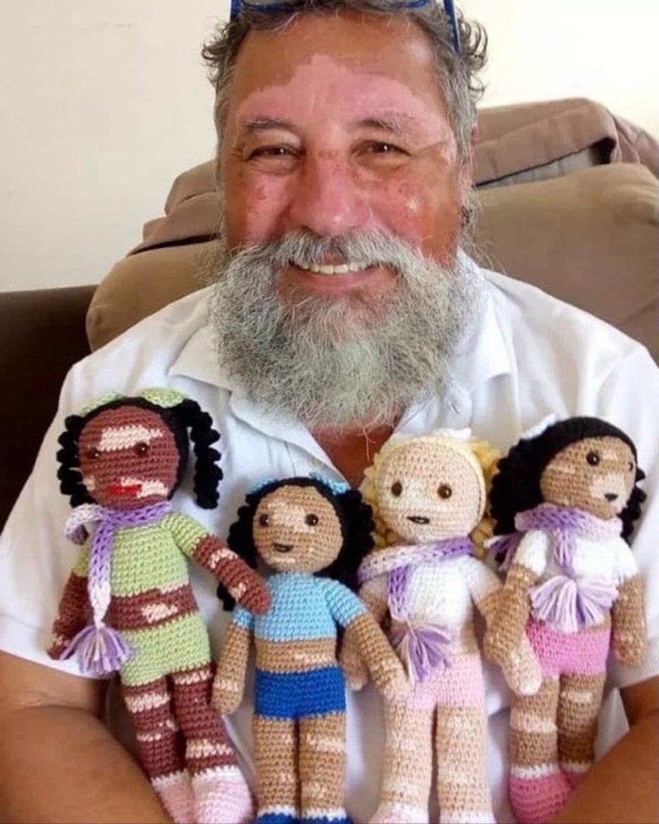 guzillier's tweet photo. a grandfather with vitiligo started hand-crocheting dolls with the same patches so kids with the condition could finally hold a toy that looks like them

story is doing numbers on the TL right now and it melts everyone who sees it

sending 100% of fees to Vitiligo Support International

https://t.co/jtcHbqb6kI