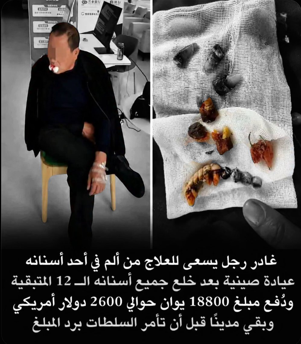 A000R_'s tweet photo. عندما يتحول ألم سن إلى خلع كامل 😳

هل تتوقع أن تذهب لطبيب الأسنان بسبب ألم في سن واحد، ثم تخرج وقد خُلعت جميع أسنانك المتبقية؟

رجل صيني يبلغ 63 عامًا يقول إن هذا ما حدث معه بالفعل.

تابع للقصة بقيه.. https://t.co/E0bFm7fxMd