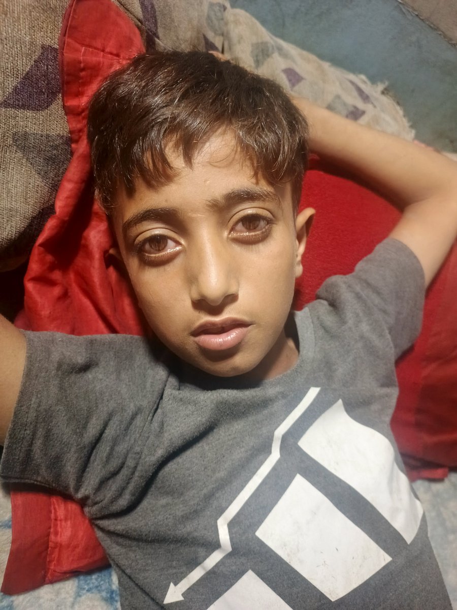 0fa3gs's tweet photo. My child is very sick, with a high fever, severe cold, and chest and tonsil inflammation. 💔 He urgently needs medicine. I need $100 for his treatment and food. Please help or share. 🙏💊
https://t.co/cPF2nUdGoA https://t.co/q4POOkSxD5