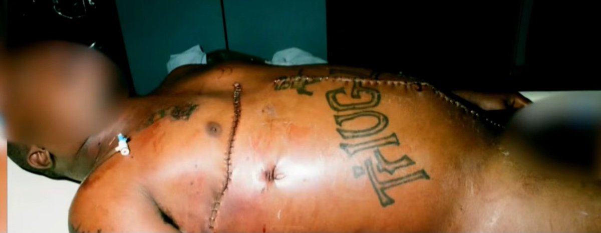 WeOutHereNews's tweet photo. 🚨🚨🚨  GRAPHIC WARNING

Never before seen photos of TUPAC SHAKUR AUTOPSY shown to jury during Keffe D's murder trial

Happened minutes ago https://t.co/DKhkyvHLfn