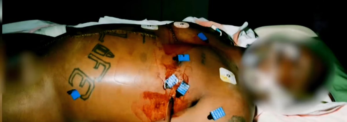 WeOutHereNews's tweet photo. 🚨🚨🚨  GRAPHIC WARNING

Never before seen photos of TUPAC SHAKUR AUTOPSY shown to jury during Keffe D's murder trial

Happened minutes ago https://t.co/DKhkyvHLfn