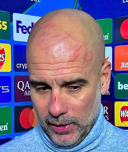 being_maruf360's tweet photo. Rodri, Tijjani gone. Savinho &amp; Nico G potentially gone. Doku &amp; Nunes injured. No backup winger or RB, keeper basically a amputee other than shot stopping.

Enzo Fernández potentially coming in. Kovačić, Grealish &amp; Marmoush still here.

Yeah, We’re getting found guilty tomorrow https://t.co/hjbWvzSuDI