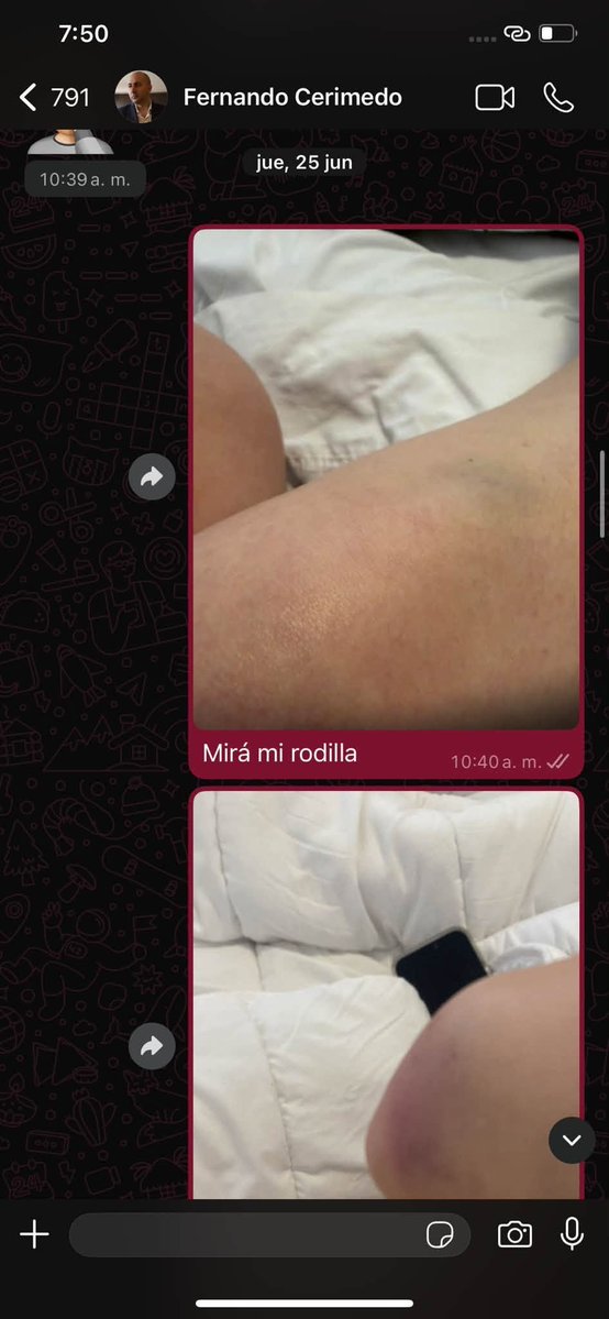 ResistenciaNac_'s tweet photo. 🚨 Aparecieron los chats donde Nadia Beller le reclama a Fernando Cerimedo después de haber sido golpeada y ahorcada.

Cerimedo fue uno de los principales asesores de campaña de Milei. Ningún libertario salió a decir ABSOLUTAMENTE NADA sobre el tema. https://t.co/H3RHOMwcyq