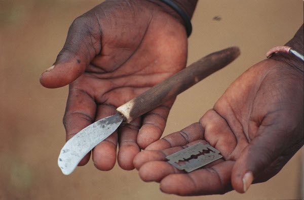 lefilsdaffou's tweet photo. Quand on parle d’excision, c’est de cela qu’il s’agit : des fillettes souvent de moins de 5 ans qu’on attrape de force et à qui l’on coupe le clitoris avec un couteau ou une lame de rasoir, sans anesthésie. Une violence extrême, infligée alors qu’elles se débattent et crient de douleur.

Et pourtant, certains trouvent encore le courage de faire campagne, à visage découvert, pour le maintien de cette pratique. Je savais que certains la soutenaient dans l’ombre, mais voir des personnes en faire ouvertement la promotion est révoltant.

La vidéo est choquante, mais parfois il faut montrer la réalité pour sensibiliser et faire prendre conscience de la gravité de ces actes.