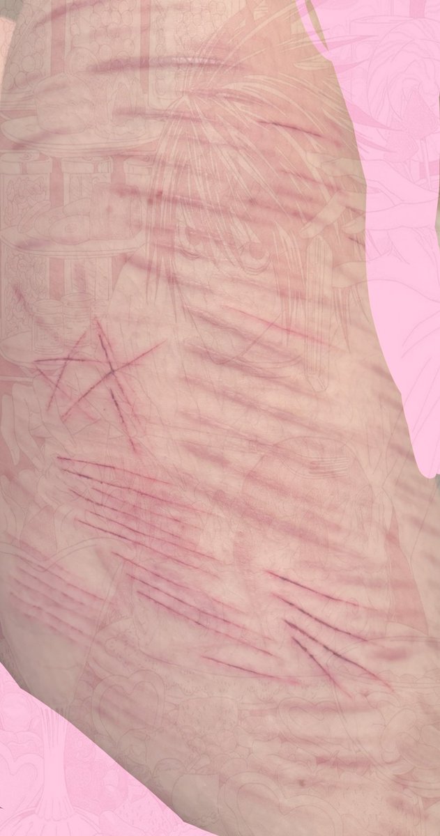 hisbabydoll4ev's tweet photo. as requested!! my full thigh for scarspo !! 

TW FAKE FX FOR HALLOWEEN https://t.co/pgzAqgYHsq