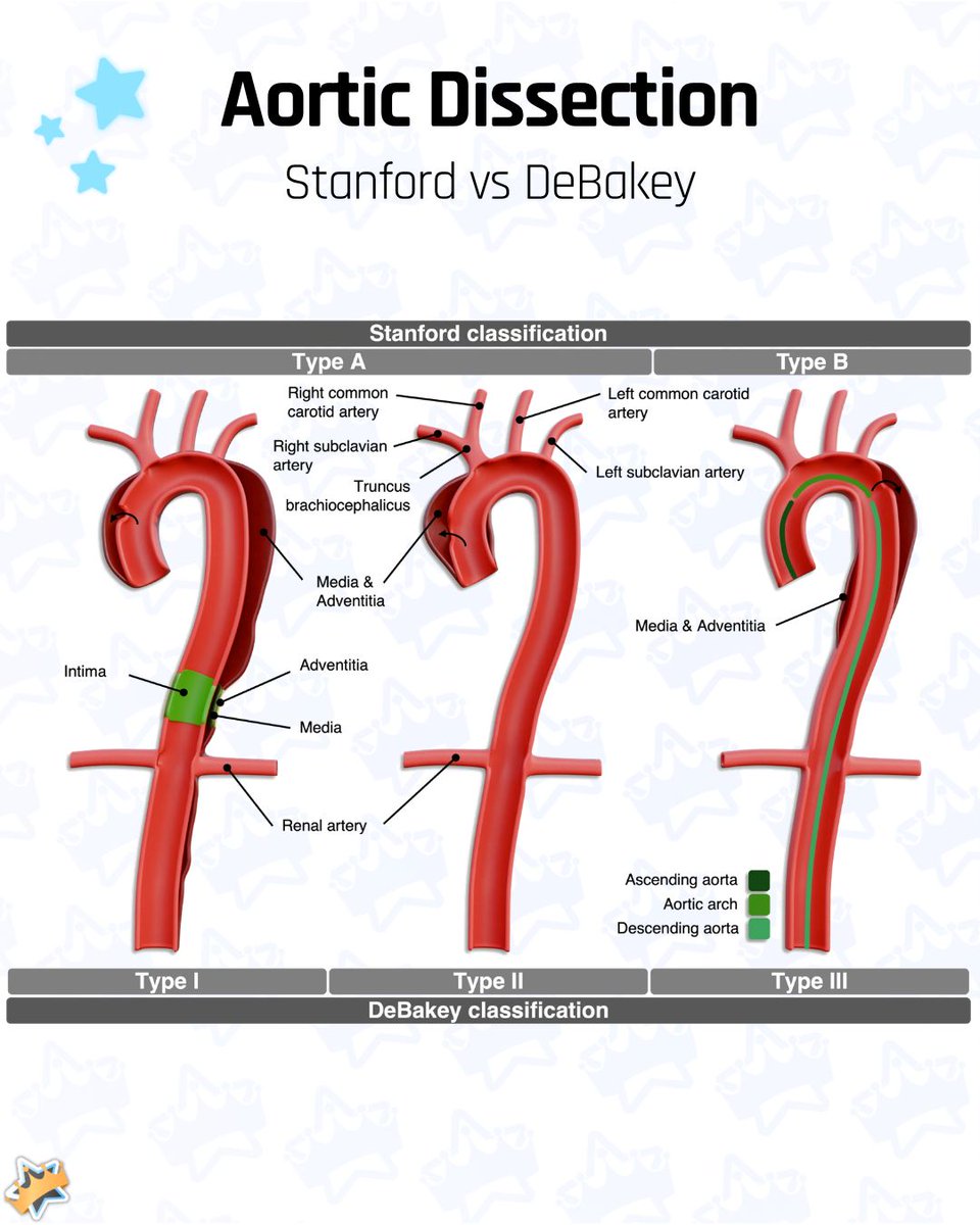 AnKingMed's tweet photo. 🫀 Mastering aortic dissection is vital for high-yield exam prep and clinical practice!

⭐ Want to study less and remember more? Create an account on AnkiHub via the link in our bio! https://t.co/xBmclqMQQV