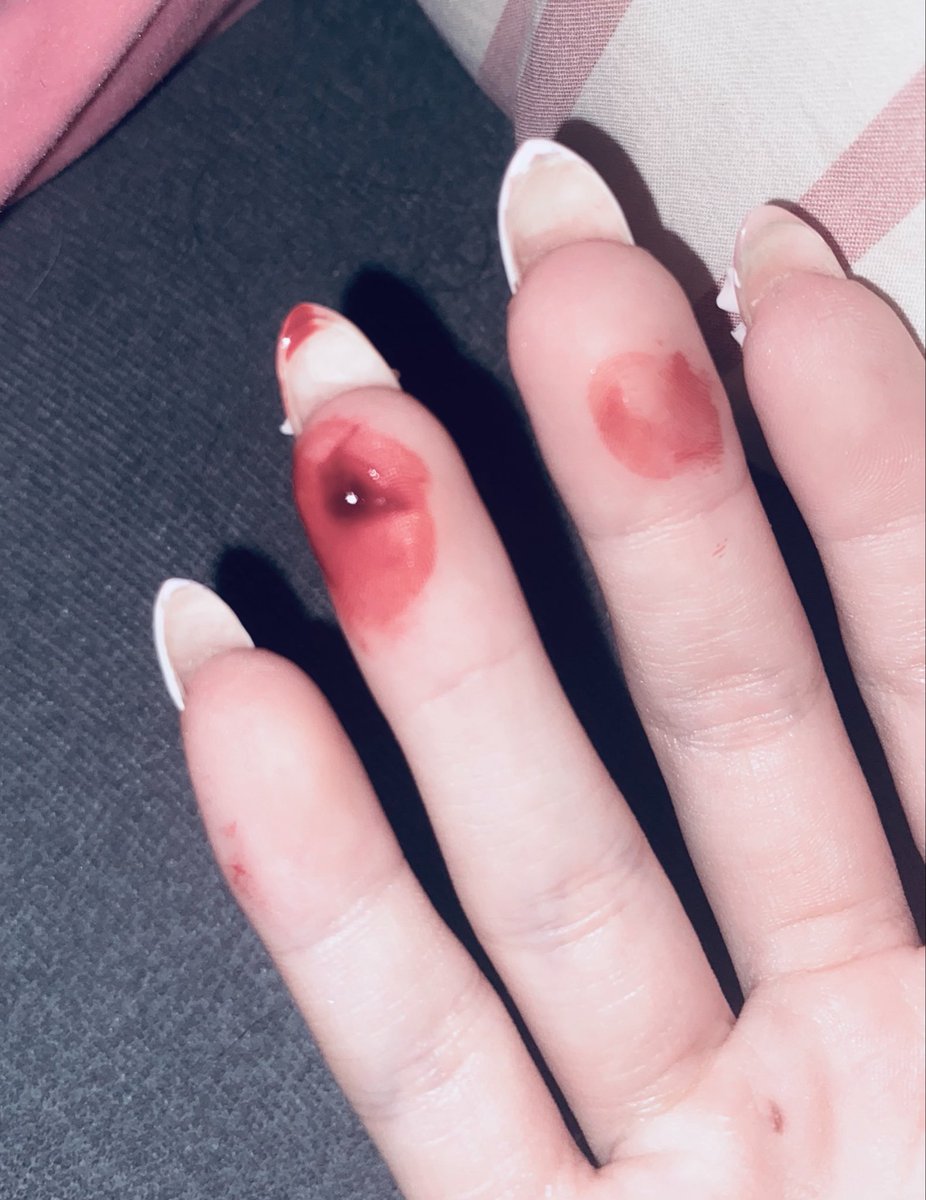 Angelirraa's tweet photo. First time finding a clot 🤔🤔🤔 https://t.co/Gj4l5uduSB