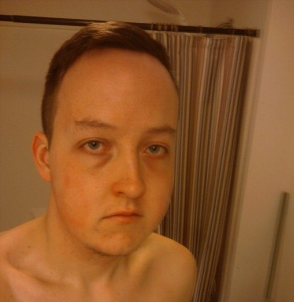 IncelsCo's tweet photo. A few millimeters of bone is all it takes to change your life. https://t.co/HwrMocWfAR