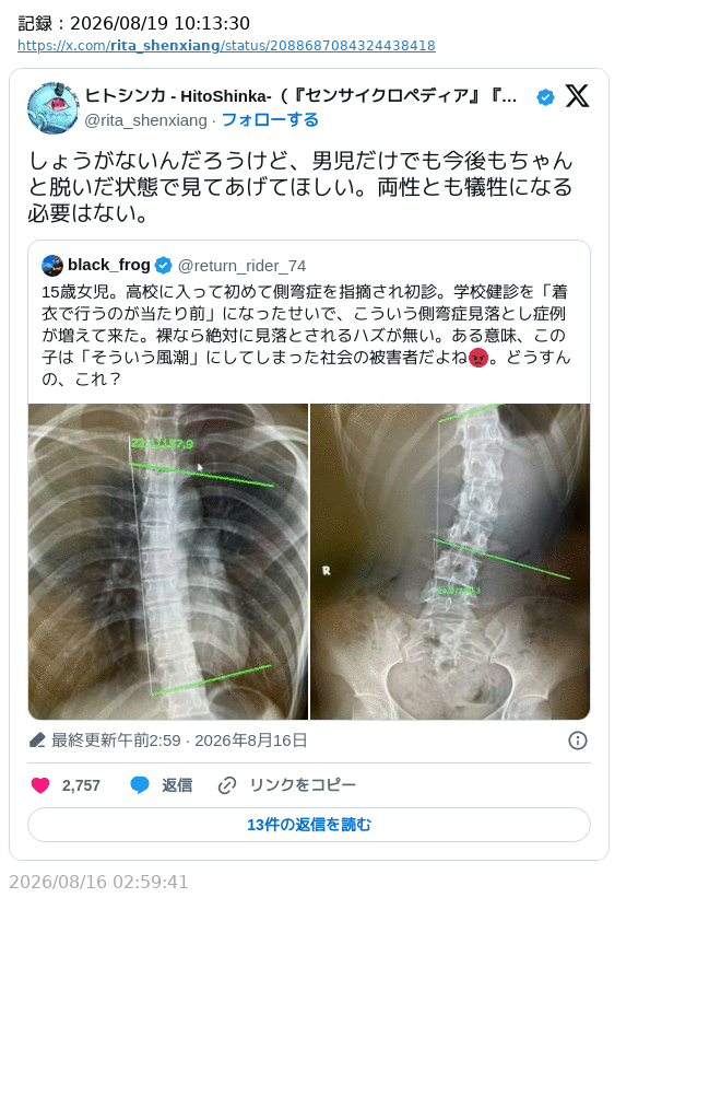 sakami_keniti's tweet photo. 「『男児だけでもちゃんと脱いだ状態で見てあげて』って、じゃあ女児の側弯症は見落とされてもいいの？」

…だからそれを言い出したのはお前らだろうって言う。
記憶力が揮発性なのか？ https://t.co/pE5soRc4yb