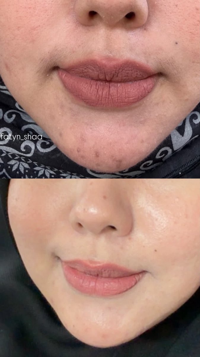 fatyn_shaa's tweet photo. Maap shakap…
Kalau u jenis tak pndai pakai foundation mcm i,
Nanti pergi W4TSONS cari sunscreen ALLIE code Sunny Apricot…

Finishing dia glowing terukss , muka nmpk mcm u makeup🤚🏻￼ https://t.co/37wBygAAh2