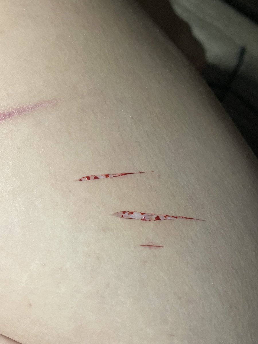 alinieweenie's tweet photo. SFX MAKEUP!!! FAKE, THIS IS JUST MAKEUP
#shrtwt #styro #babybeans #slittwt https://t.co/UucMTYTkhQ
