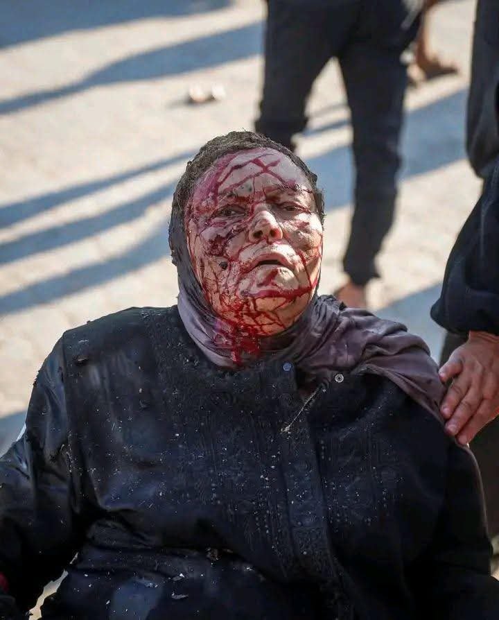 muminbiallah's tweet photo. أيصير دمي بين عينيك ماءً!؟

- غزة|| 18 أغسطس 2026م. https://t.co/RlPKhU54uc