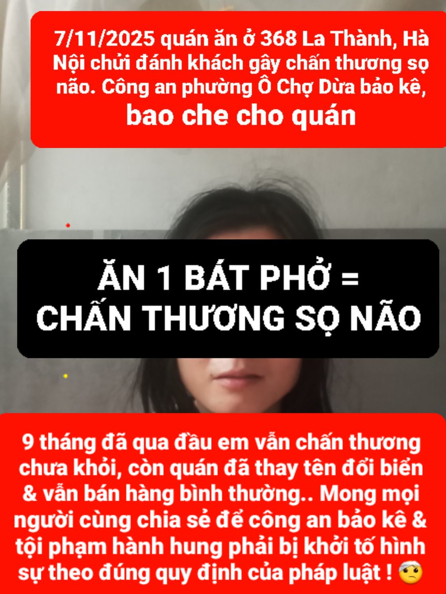 meocu's tweet photo. @Vik2Vi Vụ của e công an phường bao che cho tội phạm đọc cho em viết đơn đề nghị bồi thường có 1.5 triệu đồng thôi mọi ng ạ 🤕🙏🏻 1.5tr = sửa điện thoại bị vỡ + chụp chiếu điều trị + dưỡng thương chăm sóc ăn uống 9 tháng qua... h làm đơn hình sự có được k nhỉ? https://t.co/u3b8RU1Xpc