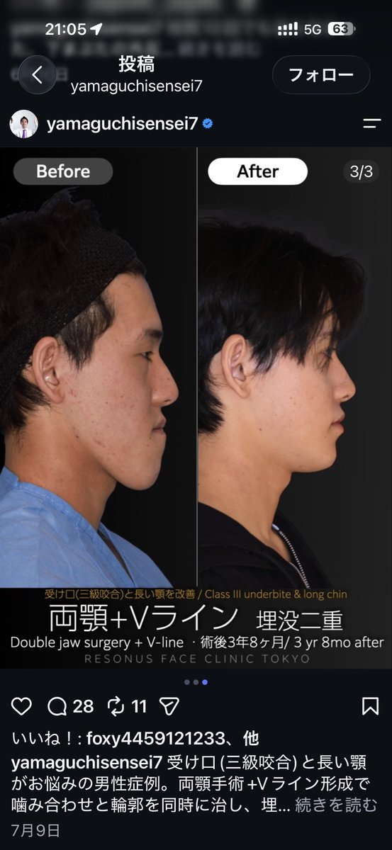 hanashuchnku's tweet photo. 整形流石に夢ありすぎると思ったが
このビッグドリームの費用見て
目ん玉飛び出てまだ眼窩底に戻ってない https://t.co/19IHgNOBKv