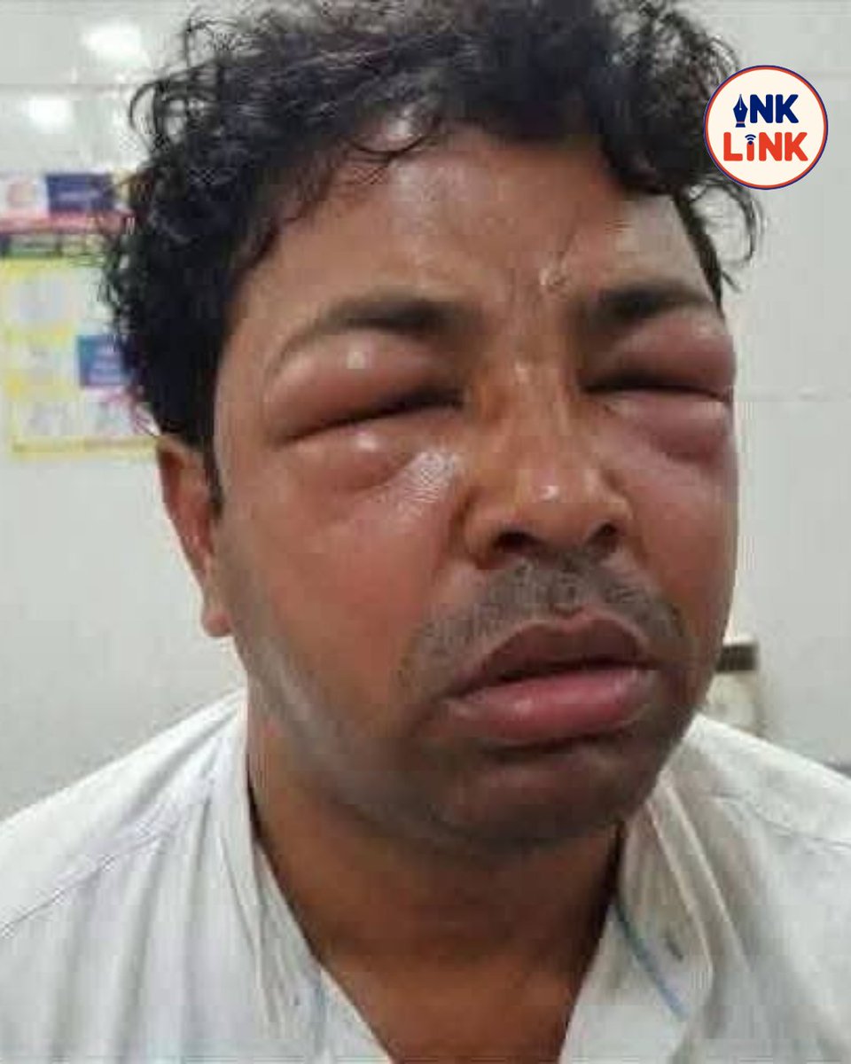 inklinkonline's tweet photo. भाजपा के नेताओं को दौड़ा-दौड़ा कर देवास में तिरंगा रैली यात्रा के दौरान DJ वाहन के पेड़ से टकराने पर मधुमक्खियों ने हमला कर दिया भाजपा के नेताओं को दौड़ा-दौड़ा कर डंक मारे..
#Dewas #MadhyaPradesh #TirangaRally #BeeAttack #BJP | ViralVideo | DewasNews | MPNews https://t.co/U6OJcTYEJN