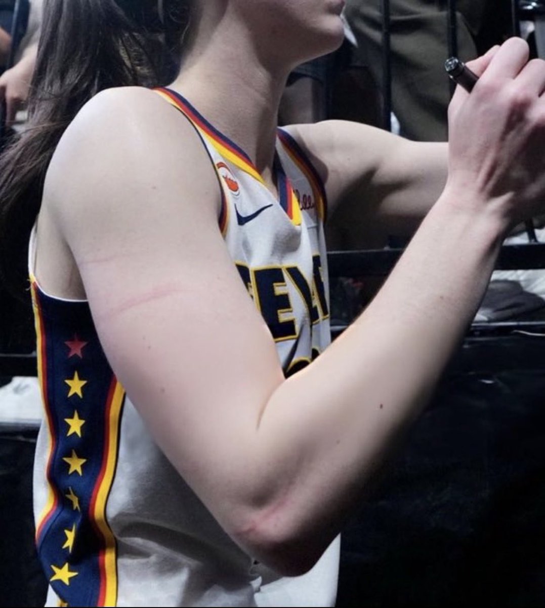 tim_baron's tweet photo. @UnderdogWNBA Mabrey deliberately scratching, very nasty work. https://t.co/veb7ApsVWj