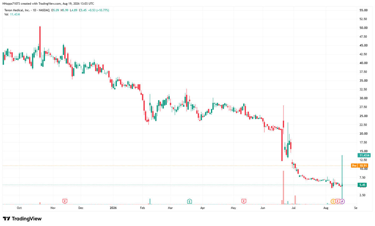FrancesJatkfc's tweet photo. $TNON
Current price:$5.45
Upside target :$9.00–$10.91
Long‑term steep downtrend recently showed strong volume‑driven rebound momentum. If price holds above $4.80 support, expect a rebound toward target zones.
#TNON #USStocks #SmallCapTrade https://t.co/iTtzKrte5E