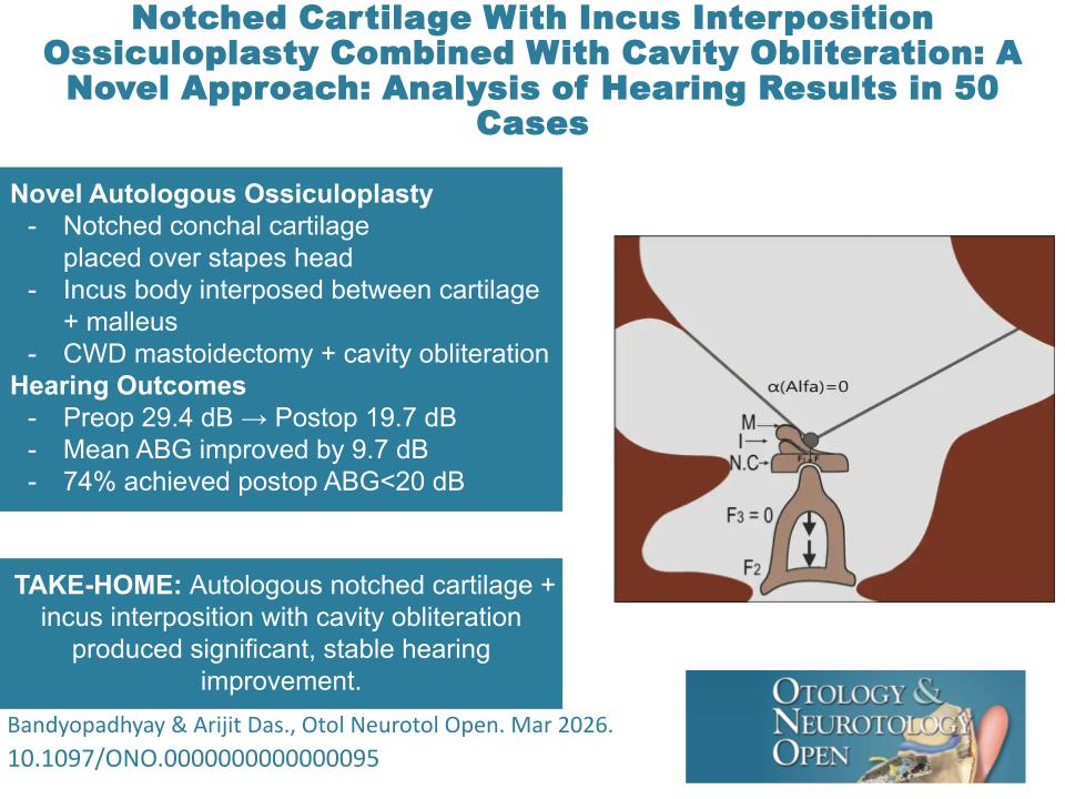 ONOjournal's tweet photo. Can a simple autologous reconstruction provide stable hearing outcomes after ossicular erosion?

Read more: https://t.co/P2B94Rs77i

#Ossiculoplasty #Otology #HearingLoss #ChronicOtitisMedia @ONOjournal https://t.co/Y9ZnSmyZIg