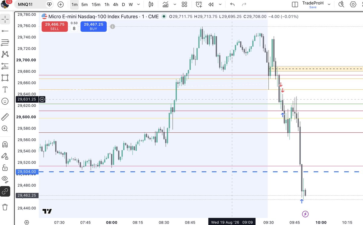 Anil018310's tweet photo. Here I go 
#nq100
$nq https://t.co/iJOzp9U8zC