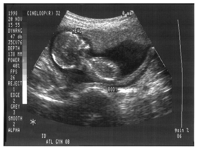 CatholicVote's tweet photo. 🚨 NEW: U.S. Catholic bishops are launching a nationwide campaign against abortion pills.

The USCCB is calling on Catholics to pray and advocate against the growing availability of abortion pills to curb chemical abortion in the post-Dobbs era. https://t.co/xweQ4esXG4
