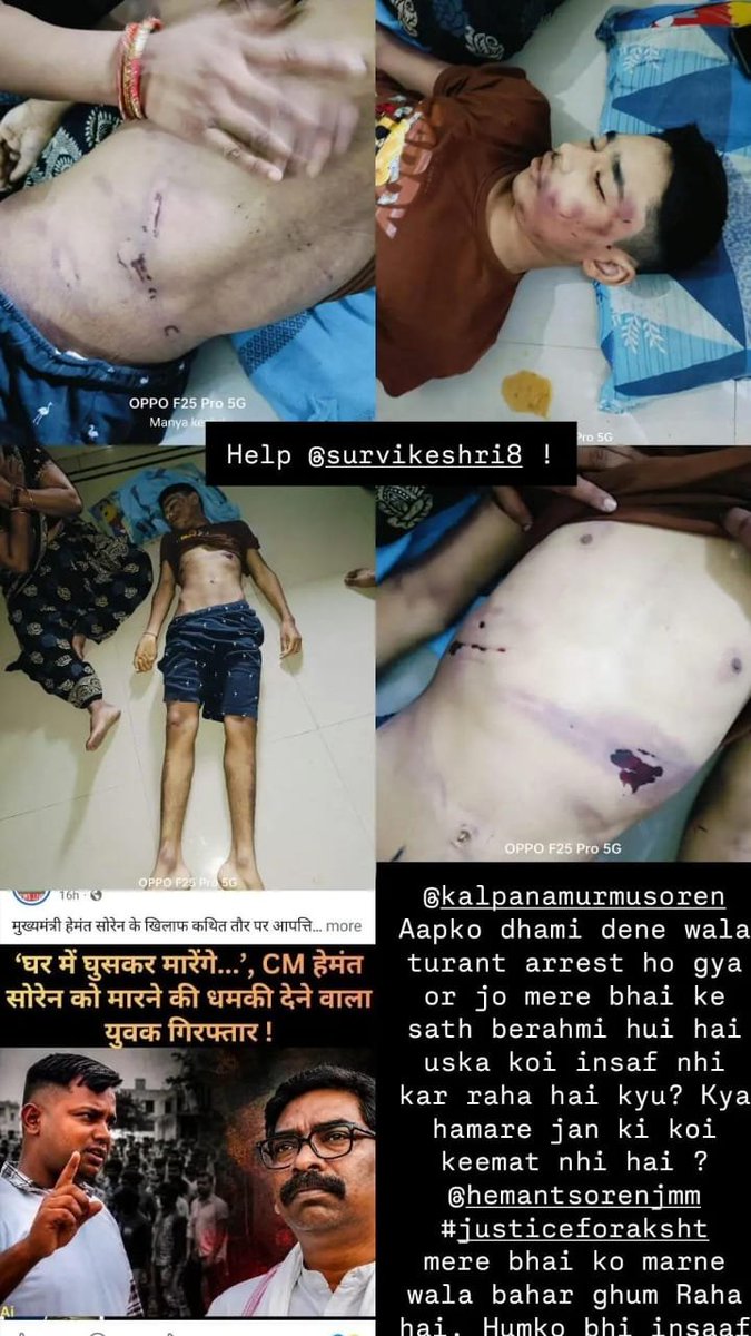 dan_fz14's tweet photo. @BJP4Jharkhand Please don't scroll past Akshat's story. He was just a 13-year-old boy whose life ended
far too soon. Stand with his family. @HemantSorenJMM @JMMKalpanaSoren
#JusticeForAkshat #BrutalMurder #Jharkhand https://t.co/8Cm5udlT2H