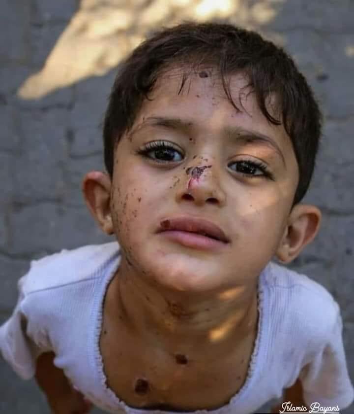 RTElice_'s tweet photo. Ey dünya, beni görüyor musunuz?

Ben Gazze’de zulme uğrayan bir çocuğum… https://t.co/6Zxh9rs8Xi