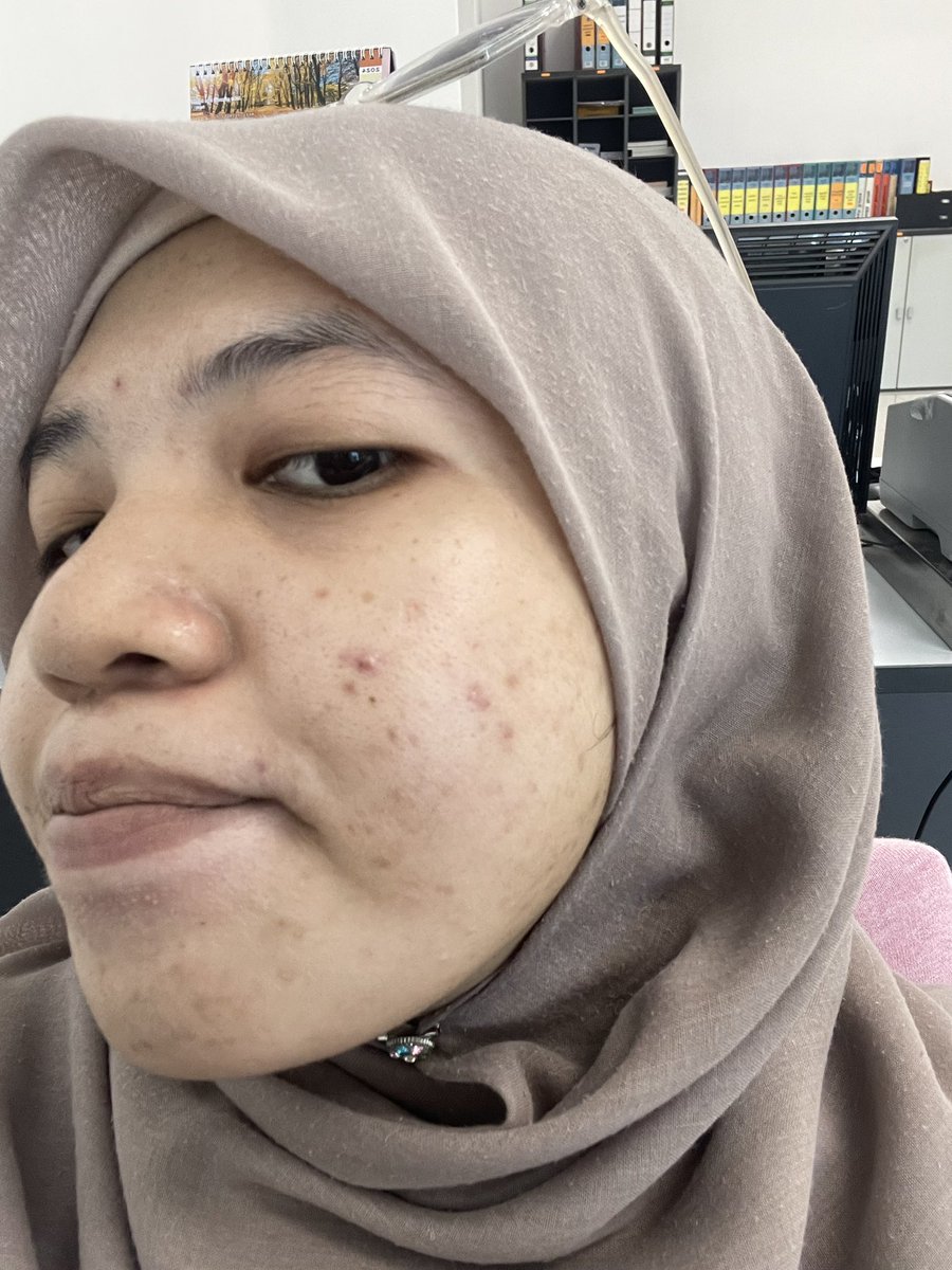 jangmihana's tweet photo. Semua angkara akak akak millenials racun sheet mask + trio ni🥹🤏🏻 semoga traffic light hijau untuk akak semua 🤲🏻💗 my skin is better now https://t.co/Joc4iBlFBf