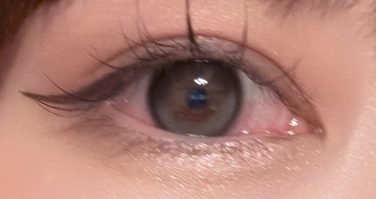 shucaca_02's tweet photo. 分かりにくいけどこれの10倍くらいは眼球の下半分だけ充血して装着時間5時間なんだけどどうして🥹 https://t.co/udND8hZWJE
