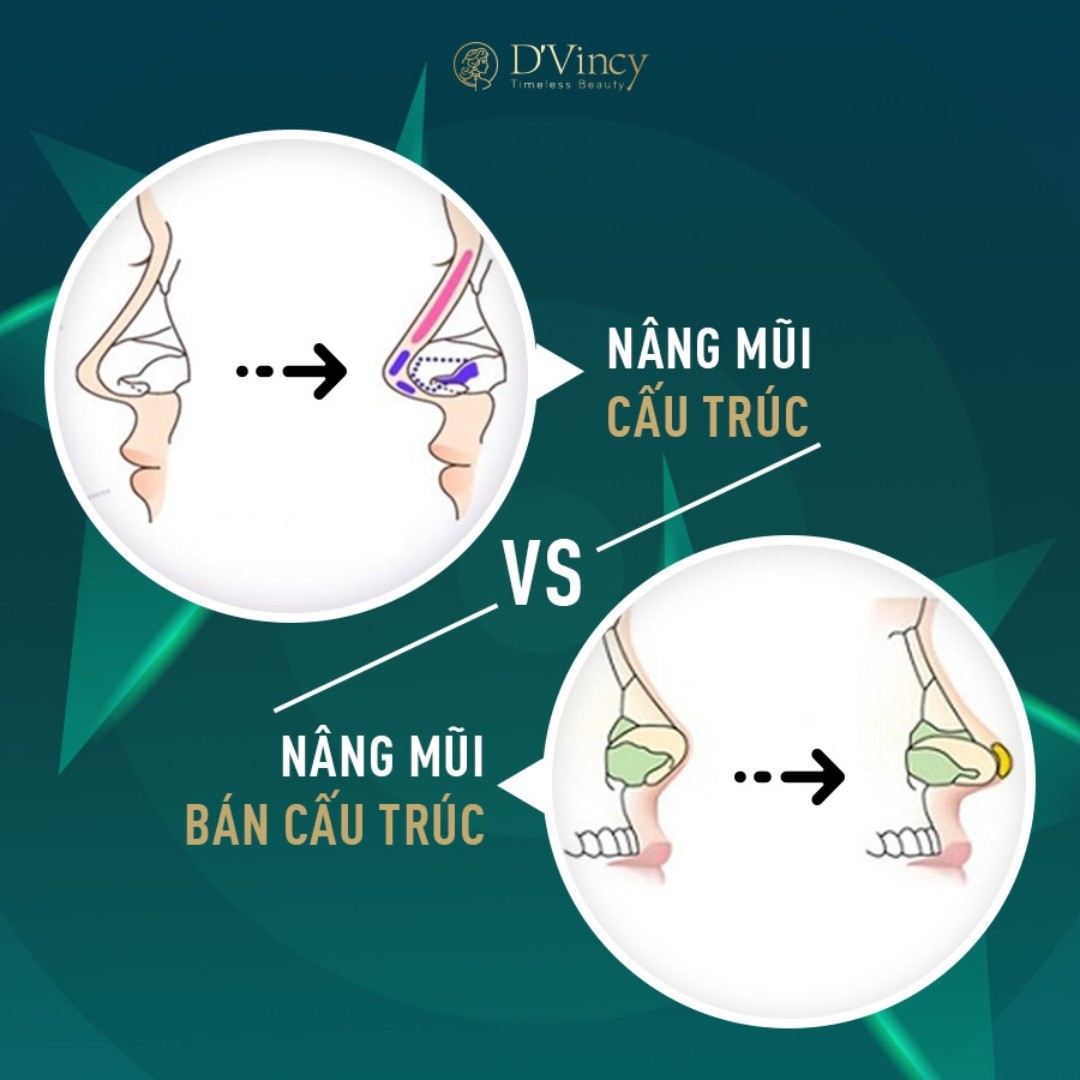 elpatronmeme's tweet photo. Structural vs. Semi-Structural Rhinoplasty

Semi-structural rhinoplasty reshapes part of the nose, ideal for low, less flawed noses. Structural rhinoplasty corrects multiple concerns such as bumps, deviation, upturned or hooked noses. S-Line suits https://t.co/ZpyMkyRLtL