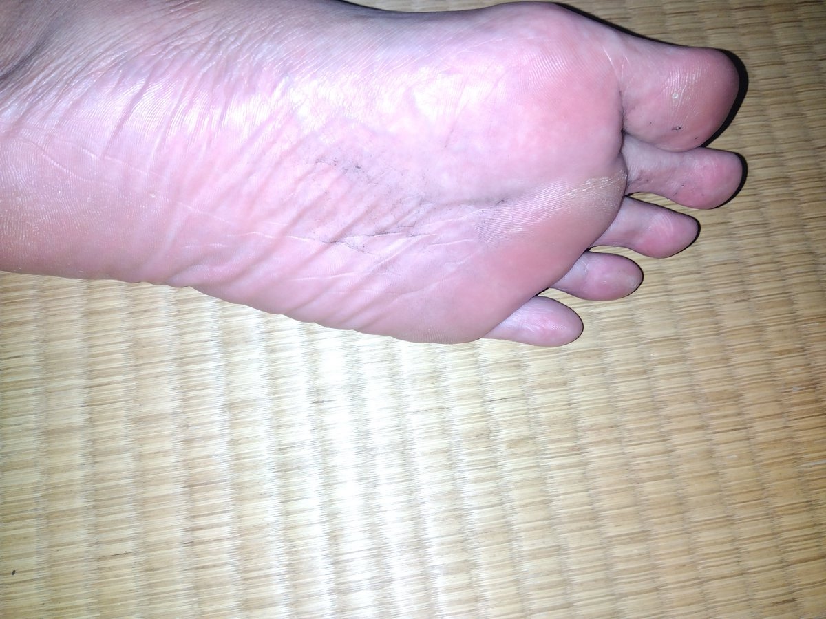 Xo4n3's tweet photo. 本日の熟成足裏👣
光の反射でドアップ写真はボツになったので、引きの全体ショットを2枚(`･ω･´)b
シワの寄り具合と指股の垢が今日もいい感じに育ってますw
​#男の足裏 #足裏 #蒸れ足 #扁平足 #GayFeet #MaleFeet https://t.co/vPo8JtzMWa
