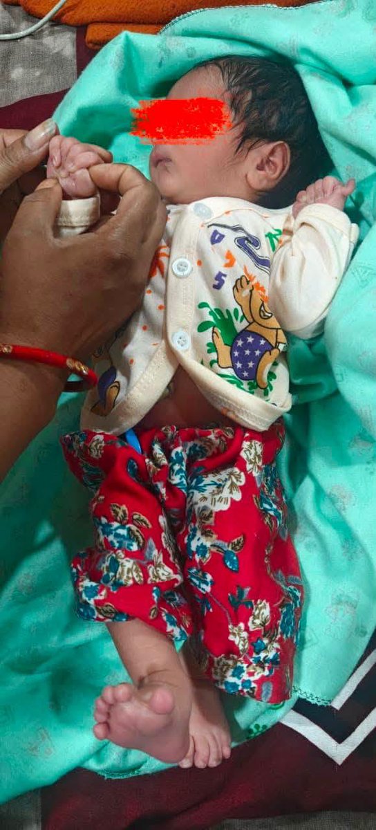sunilkhimachali's tweet photo. पालमपुर। सिविल अस्पताल पालमपुर में एक बच्चे ने 24 उंगलियों के साथ जन्म लिया है। अस्पताल में इस तरह का यह पहला मामला बताया जा रहा है। #Palampur #CivilHospital https://t.co/Ulao9NQl8j