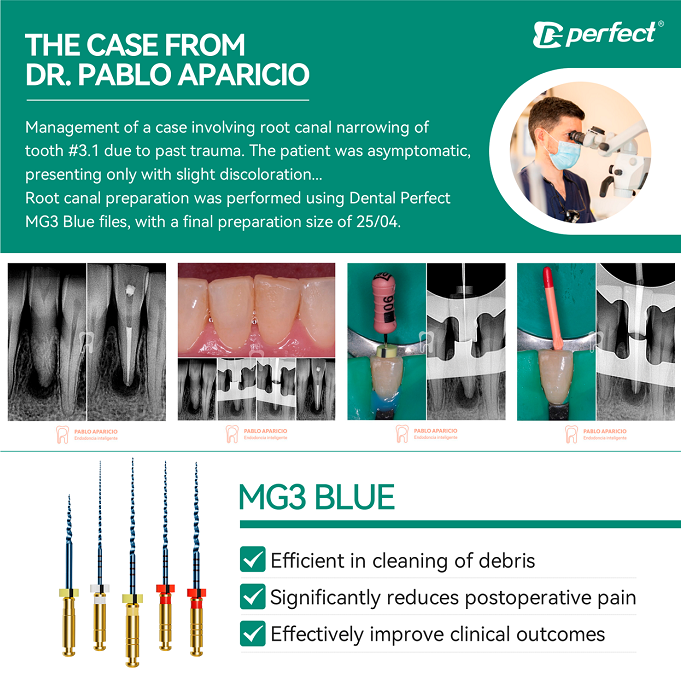 EndoPerfect's tweet photo. 🎯 Clinical excellence with Perfect MG3 Blue!

تميز سريري: قام الدكتور بابلو أباريسيو بإدارة حالة معقدة من ضيق قناة الجذر في السن 3.1 ناتجة عن صدمة سابقة، وحقق تحضيرًا دقيقًا للقناة، وانتهى بسلاسة بحجم 25/04. ✅🦷

#DentalPerfect #MG3Blue #endodontics https://t.co/RwhStLwSBD