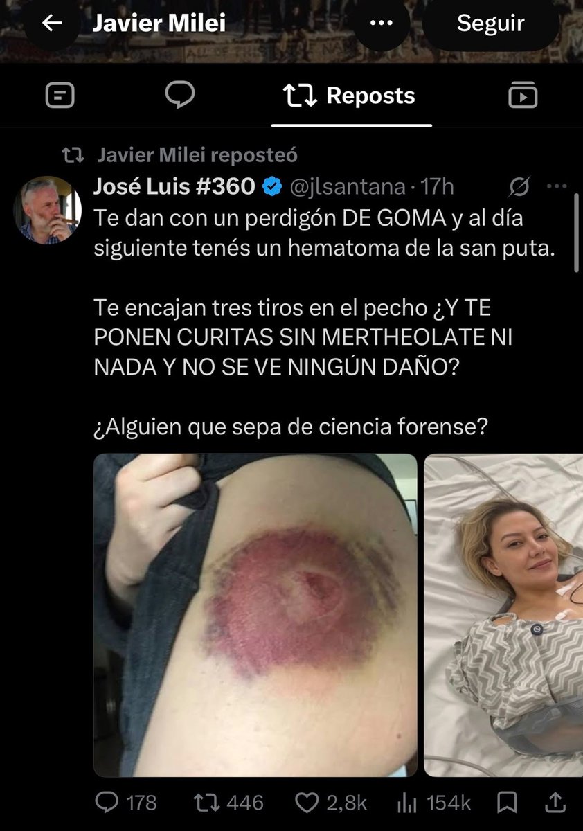 somoscorta's tweet photo. Javier Milei reposteó otros dos tuits que ponen en duda el testimonio de Nadia Beller, la expareja de Fernando Cerimedo baleada en Bolivia.