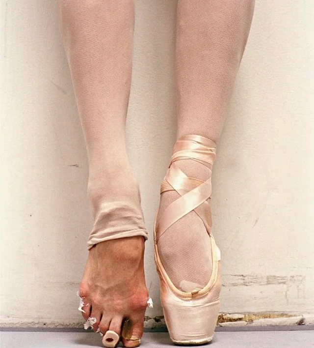 Rainmaker1973's tweet photo. Ballerina's feet after years of practice https://t.co/bG4u6B51Sk