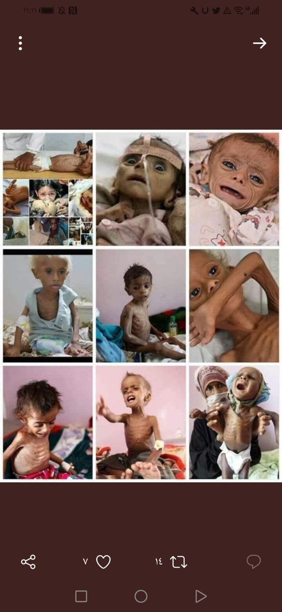 abolujinsmac's tweet photo. الاحتفال الحقيقي برسول الله يكون برفع الظلم، وإغاثة المحتاج، وإطعام الجائع، لا بإنفاق الأموال الطائلة في بلد أنهكه الفقر والجوع وانقطاع الرواتب.
   #انا_جاوع_يارسول_الله https://t.co/E9CyobBIuE