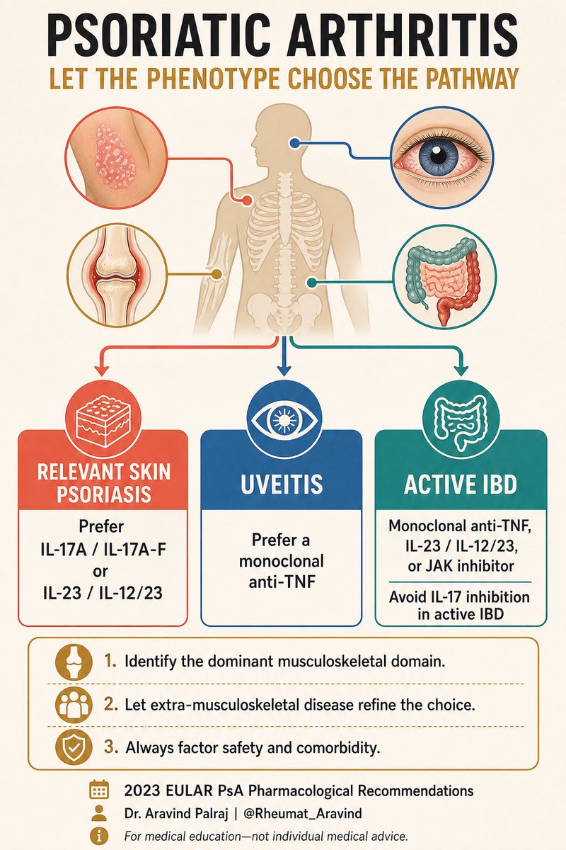 Rheumat_Aravind's tweet photo. Psoriatic arthritis: treat the phenotype, not just the joints.

Skin psoriasis → think IL-17 / IL-23 pathways
Uveitis → favor monoclonal anti-TNF
Active IBD → avoid IL-17 inhibition

The dominant domain + extra-musculoskeletal disease should guide therapy.

#PsoriaticArthritis #Rheumatology #Psoriasis #Uveitis #MedEd @DurgaPrasannaM1 @IhabFathiSulima @docakx @Drkhenaizan @ArunInamadar