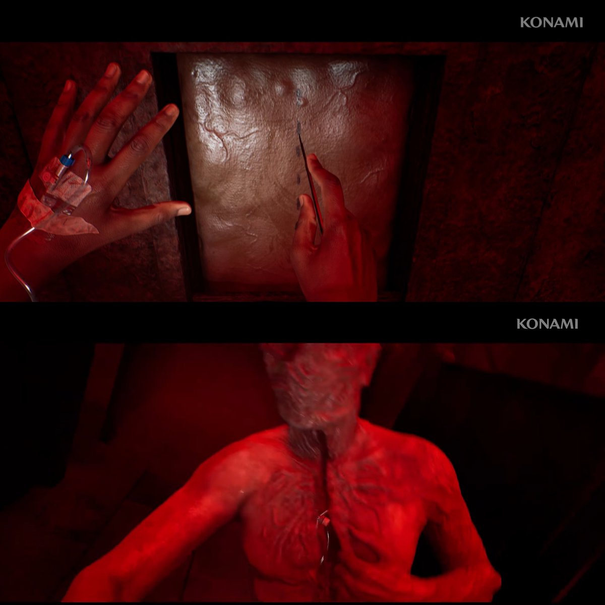 Rashmunchel's tweet photo. In the new Townfall gameplay trailer Simon unlocks a door by cutting an incision on a patch of skin. That's a reference to the monsters that attack him with a needle through an incision in their chest.
I'm sure the monsters are Simon. Their height and body type seems to be the same as Simon's, and they have an S carved in their faces. If he's indeed in a coma like I've said in previous posts, these "monsters" might be what he looks like in the real world. Their thin arms and loose skin are common among people who have been bedridden for a long time, because of muscle mass loss. If he has lost his hair in the real world like the monsters, it could be either from a disease such as cancer, or because his body is going through extreme medical stress, which can happen in patients who are in a coma.
#silenthill #silenthilltownfall