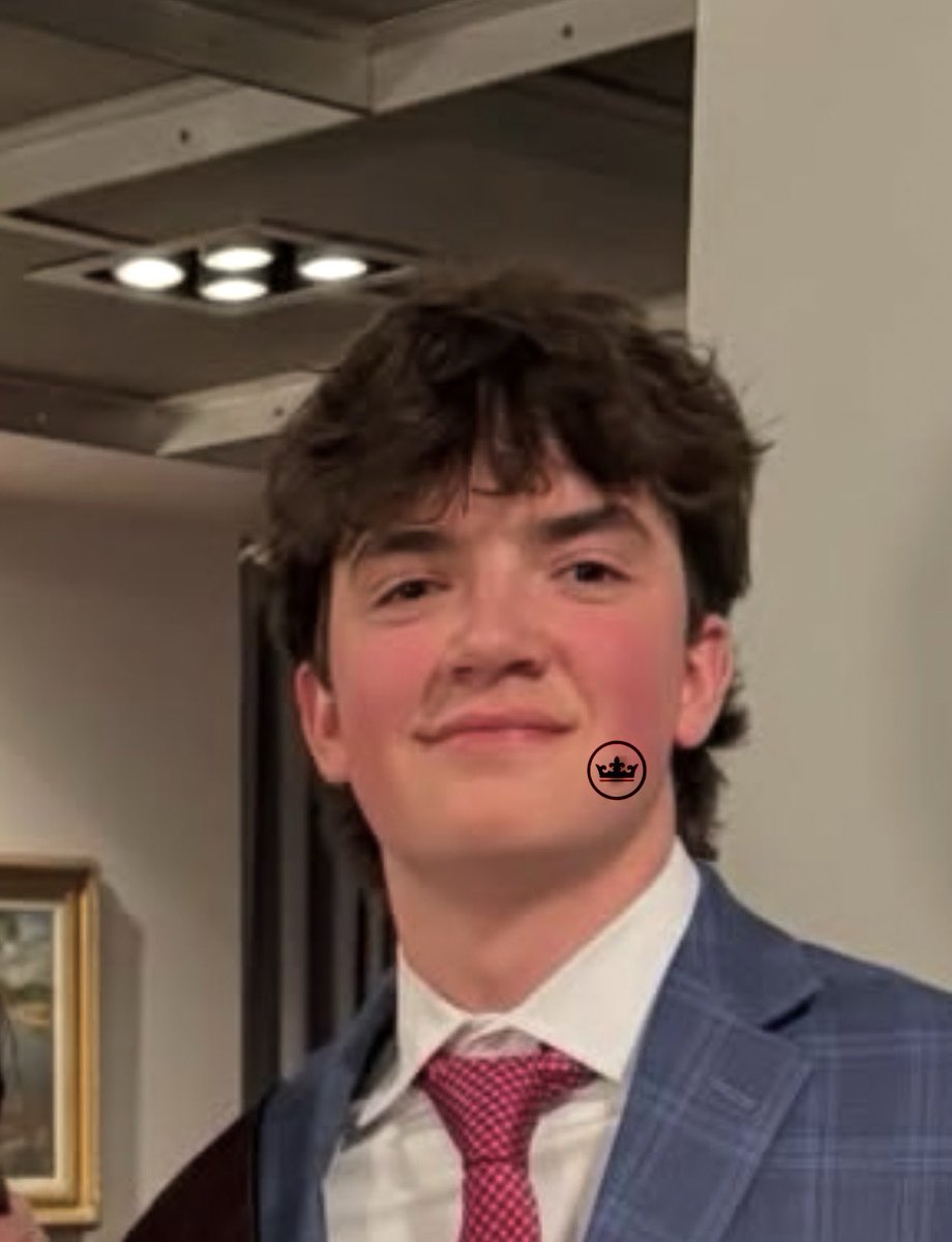 AmyGarces123's tweet photo. My gorgeous son replaced his massive mole with a tattoo to “respect the crown”  #mole #petermillar #thecrown https://t.co/VwLZGnsyDJ