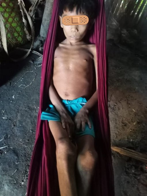 ReporteYa's tweet photo. #20Ago #Amazonas 
@Fritz_A_Sanchez: 🚨 Emergencia en Alto Orinoco         
Indígenas en estado Crítico   

El capitán indígena yanomami Eliseo Silva denuncia la crítica situación de salud de varios hermanos indígenas del municipio Alto Orinoco, quienes requieren ser trasladados con urgencia a Puerto Ayacucho.

El líder indígena advierte que llevan casi un mes esperando apoyo para el traslado, mientras en la región ya escasean los insumos médicos y no existen condiciones adecuadas para atender a los pacientes  

Hace un llamado a las autoridades nacionales, regionales y municipales a actuar de inmediato. La salud y la vida de estas comunidades indígenas no pueden seguir esperando...