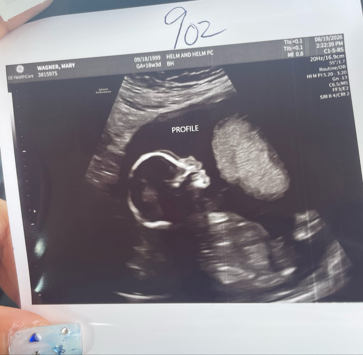Zorya444's tweet photo. next step in life with my person ❤️🤰 https://t.co/DruPrertsm