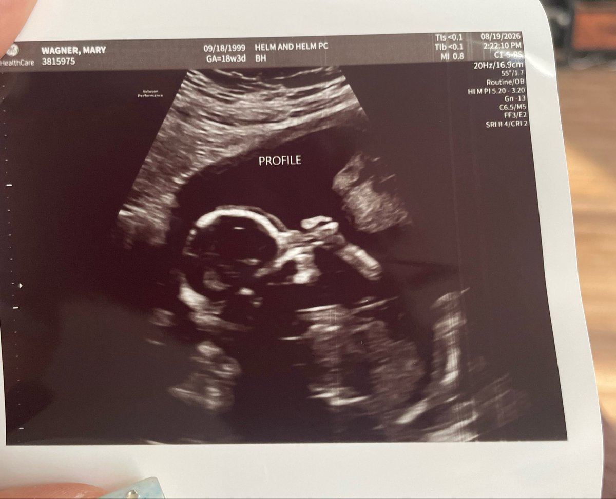 Zorya444's tweet photo. next step in life with my person ❤️🤰 https://t.co/DruPrertsm