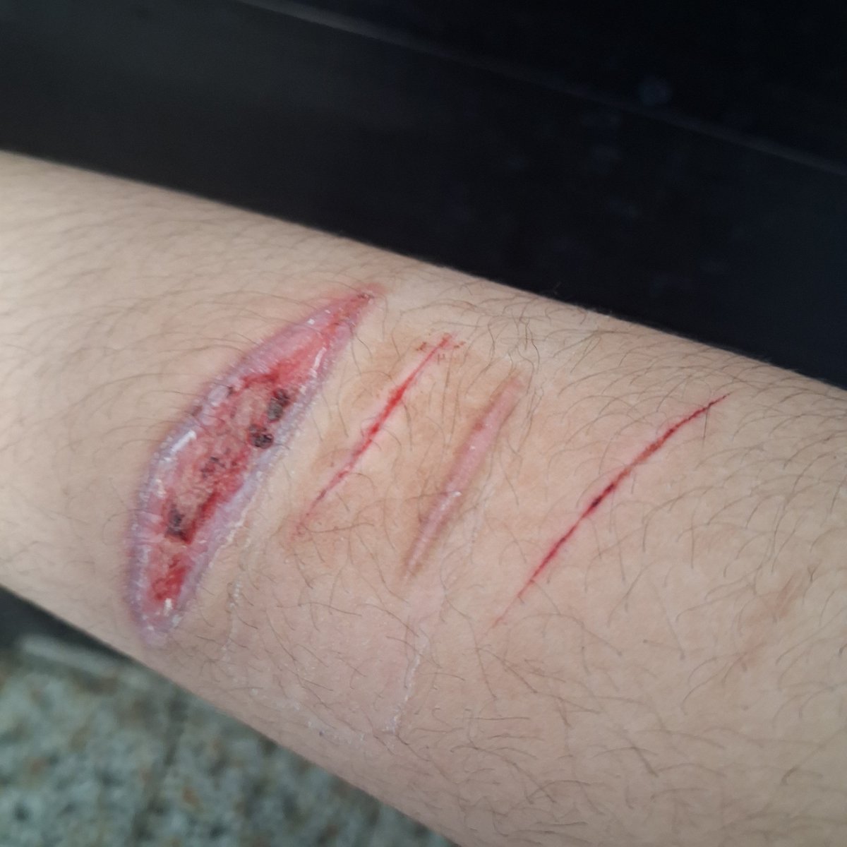 bloodyfishie's tweet photo. fake sfx make up not real
school bathroom https://t.co/wbQ3ffUMsa