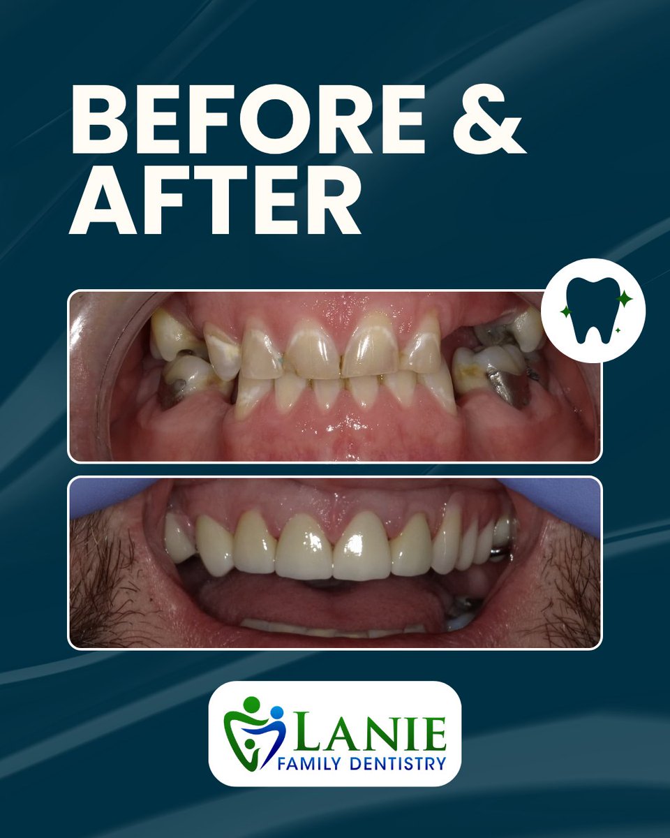 LanieDentistry's tweet photo. Our Smile Gallery features before-and-after results that show the impact of customized dental treatment. Discover how personalized care can help patients achieve their smile goals. View our gallery at https://t.co/pg1Y3yanql. https://t.co/sDYZY4I1Nk