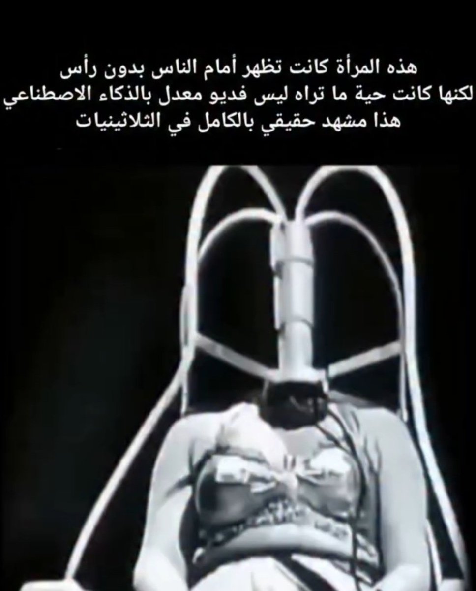 A000R_'s tweet photo. هل تصدق أن آلاف الأشخاص شاهدوا امرأة «بلا رأس»… واعتقدوا أنها حقيقية؟ 😳

القصة تعود إلى عروض السيرك والاستعراضات في ثلاثينيات القرن العشرين، واشتهرت باسم «أولغا… الفتاة بلا رأس».

لكن المفاجأة؟
تابع👇 https://t.co/6bY1CYE3XB
