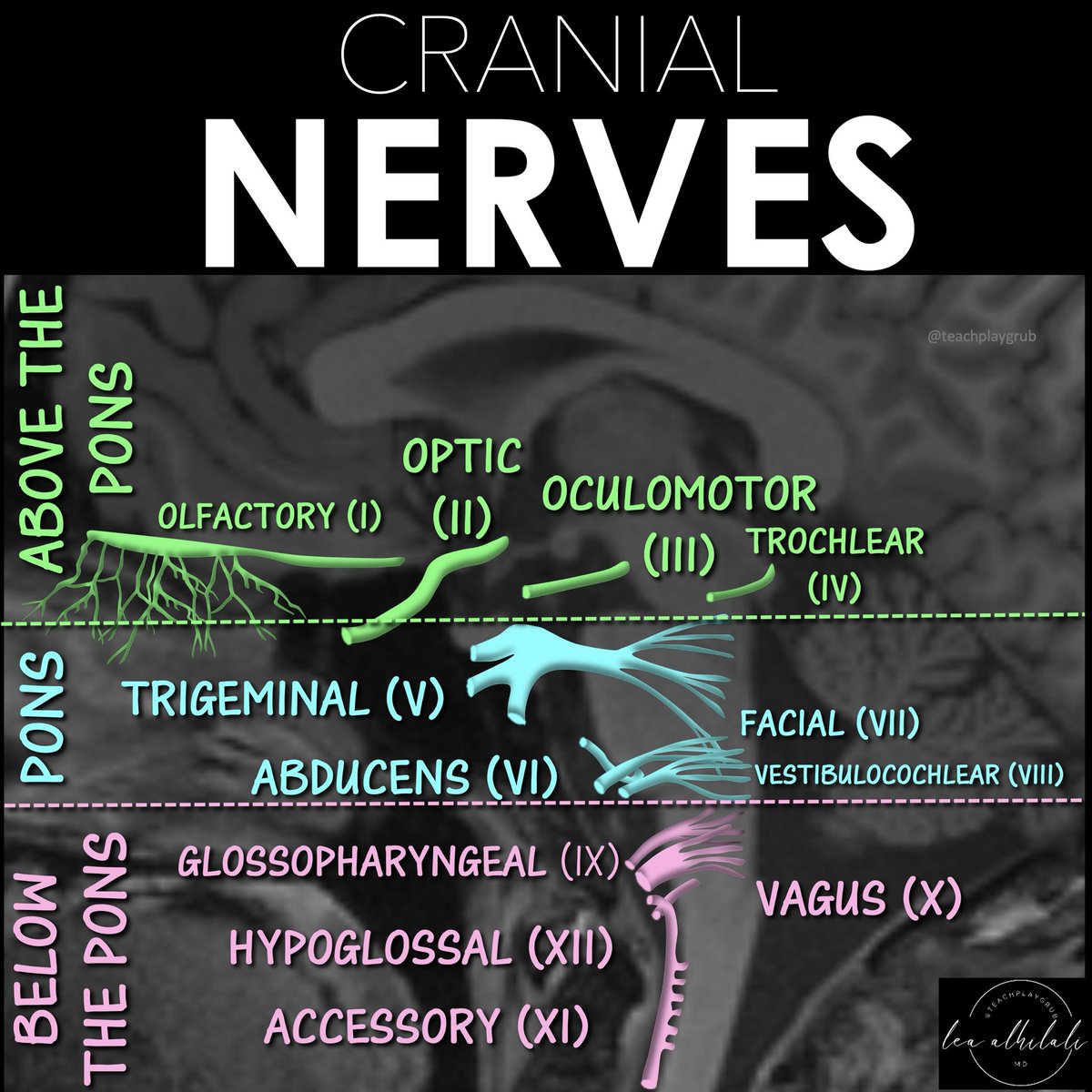 teachplaygrub's tweet photo. Just because you don’t see it, doesn’t mean it’s not there!!!

Just because you don’t see all cranial nerves on MRI doesn’t mean they aren’t there!

You must know their anatomy so you know when pathology might affect them.

Here is a figure w/the anatomy you NEED to know!

➡️Just remember this easy rule of four from Peter Gates:
There are:
🔸 4 cranial nerves from above the pons (including 2 from the midbrain)
🔸4 from the pons
🔸And 4 from the medulla oblongata!

Now you won't have be nervous when it comes to this nerve anatomy!