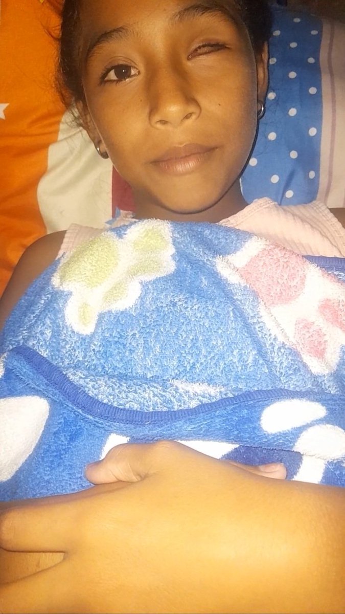 todosconirina's tweet photo. https://t.co/wM9bFFYPQW De Rodillas se lo pido por Irina Que me ayuden con un granito de arena  Nos Falta 350 dolar para los exámenes  mi Hija el Cáncer Lo tiene en la Acteria de su Cerebro Estamos a tiempo  Si se le va a su cerebro es caso perdido Por eso se los suplico Ayúdenme https://t.co/bTJyDxx8vd