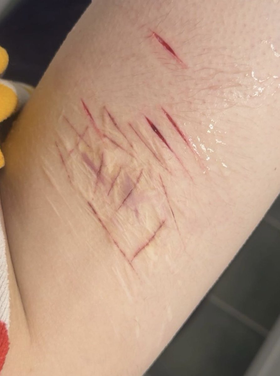 lexiishere7's tweet photo. !!FAKE SFX MAKEUP NOT REAL ENHANCED BY AI!!
i hate trying to shave around it :( https://t.co/gy6chzWVP9